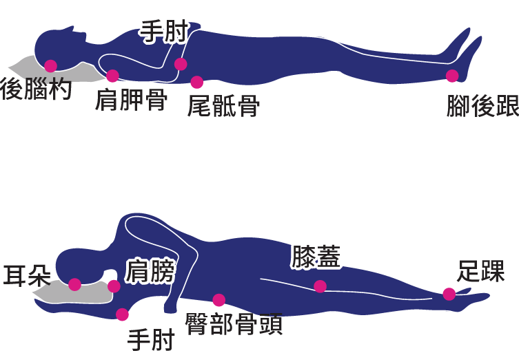 褥瘡、壓瘡、壓傷發生部位