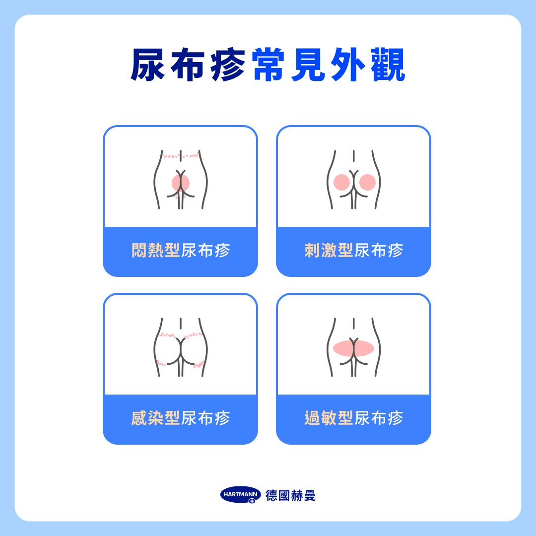 尿布疹外觀