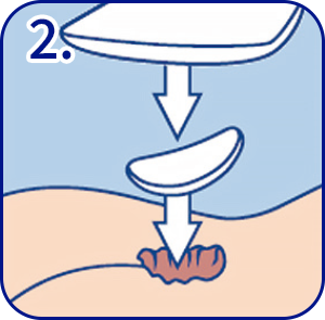 如何使用HydroClean 赫曼傷口敷料墊