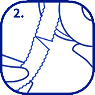 如何使用Hydrocoll赫曼涵特人工皮